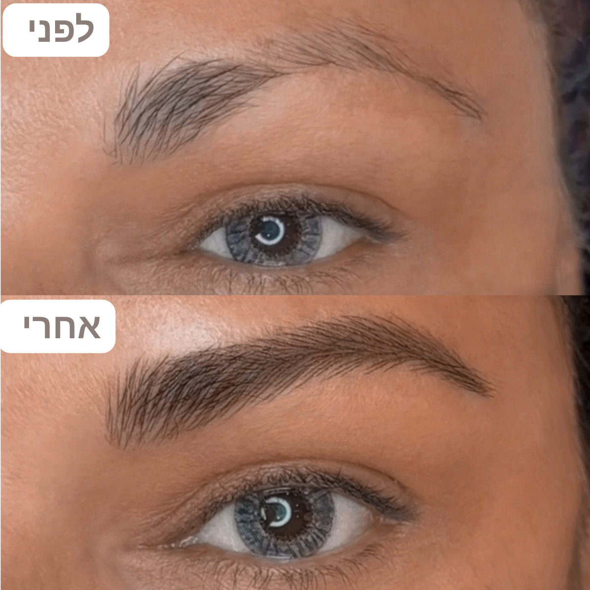 עט מיקרובליידינג לגבות